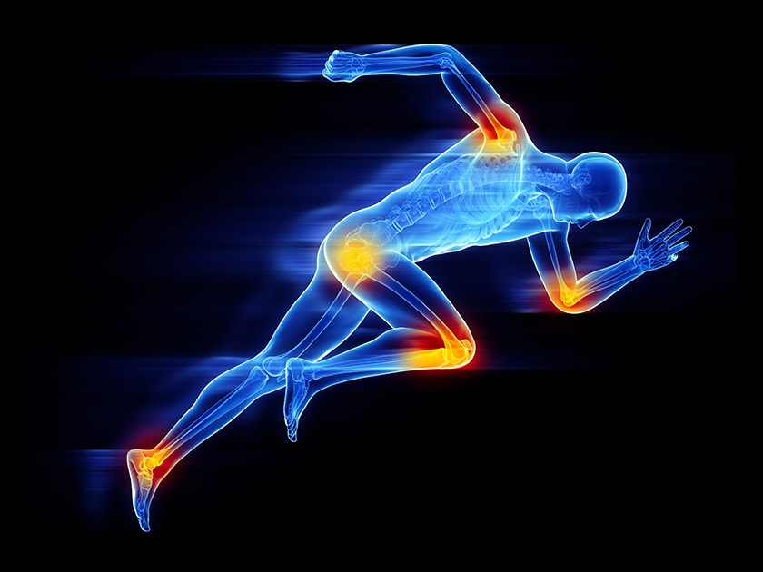 Skeleton running with osteoarthritis joint pain
